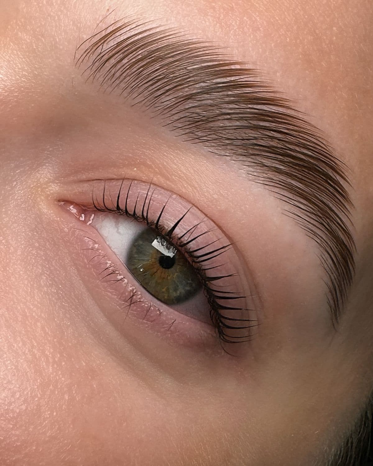 Browlift simple